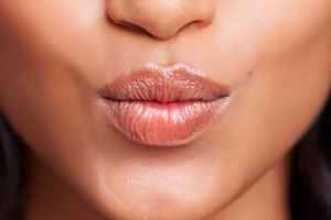 Lip Augmentation - Facial Feminization Surgery Explained